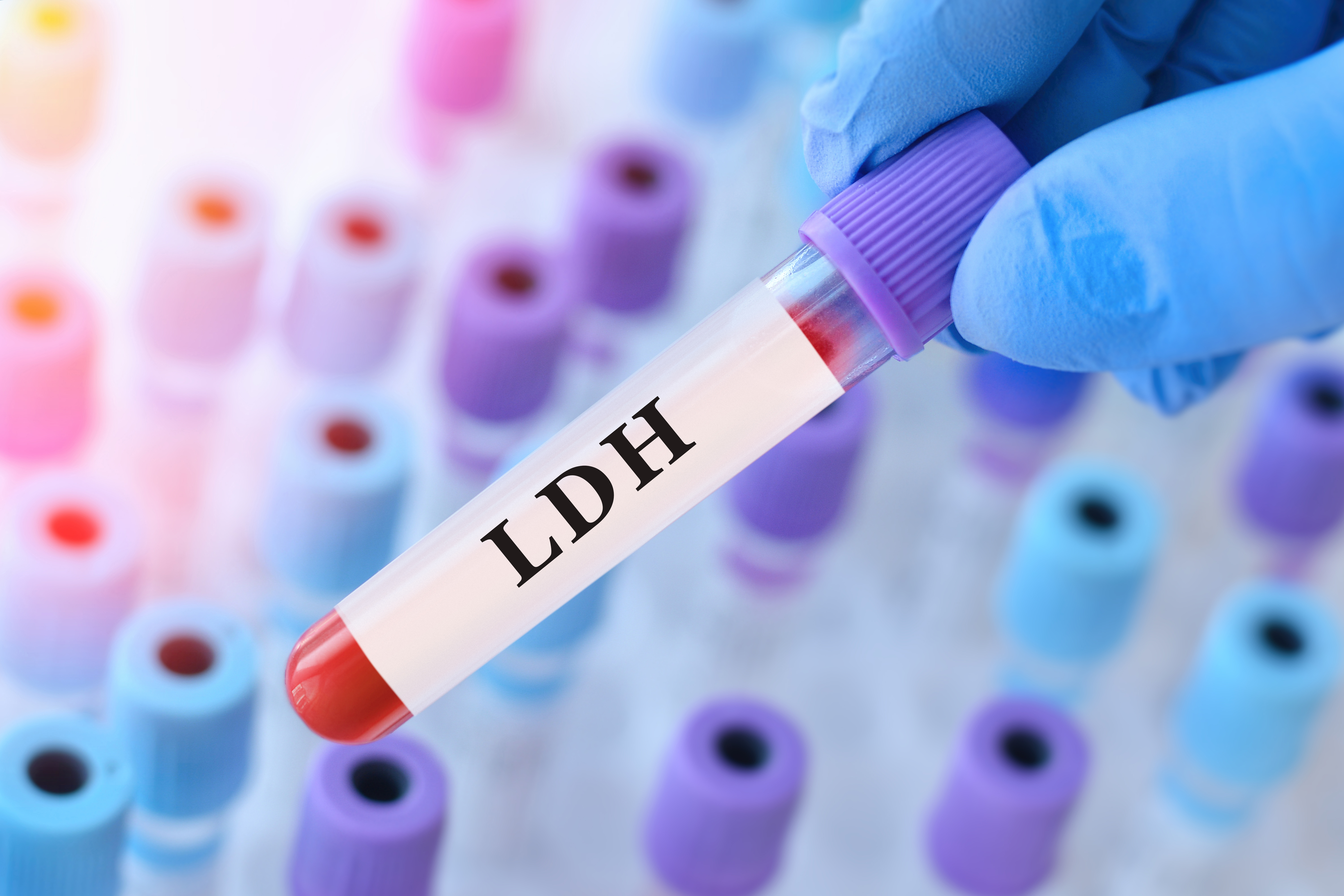 Small Peptides Targeting Lactate Dehydrogenase-A